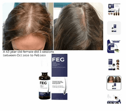 FEG Hair Growth Spray - Lees Store