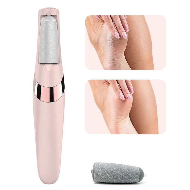 Electric Pedicure Foot File Callus Remover - Lees Store